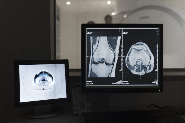 Best Xray testing services at home