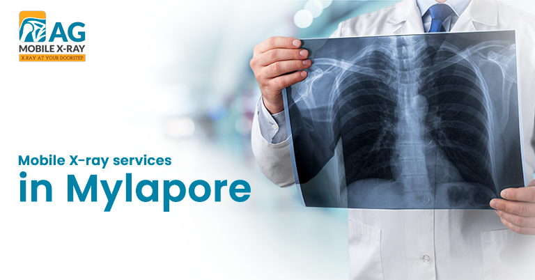 Choosing Between Clinic and Home X-rays? Here’s What Mylapore Residents Should Know