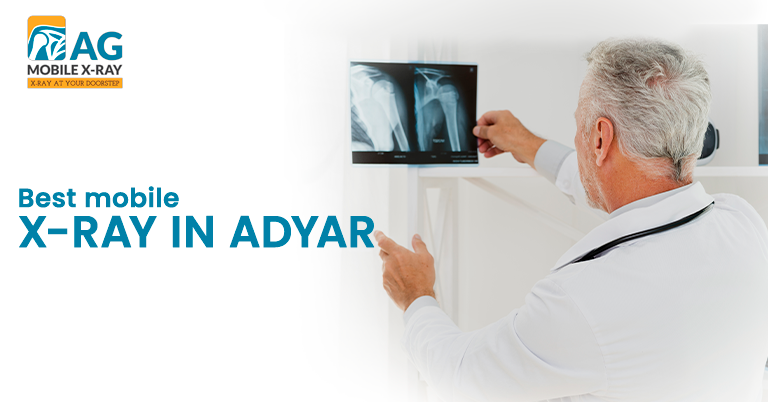 From Home to Hospital Grade: Hygiene Practices of Mobile X-ray Services in Adyar