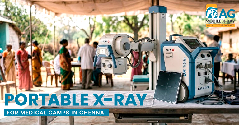 Portable X-ray for Medical Camps in Chennai: Scalable Imaging Solutions for On-Site Healthcare