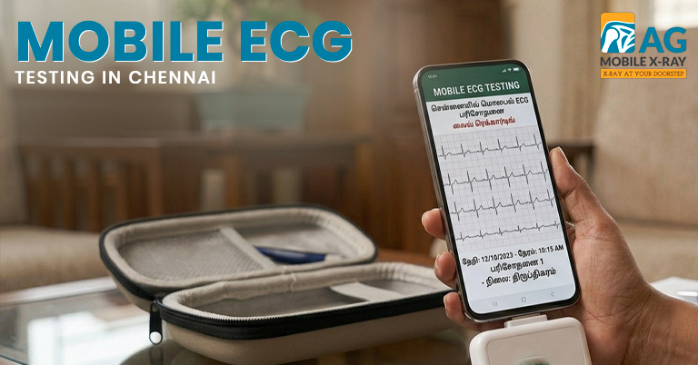 Why Mobile ECG Testing in Chennai is Becoming the Future of Home Healthcare