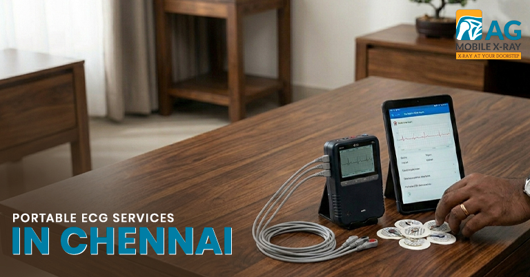 Portable ECG Services in Chennai: Smarter Cardiac Monitoring for Modern Healthcare