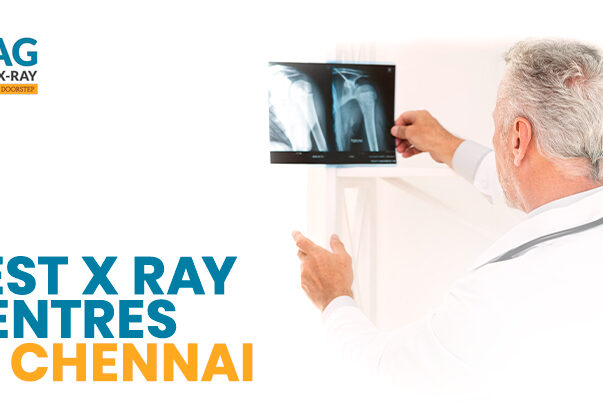 Home X-Ray Service in Chennai