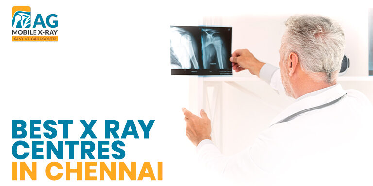 Home X-Ray Service in Chennai