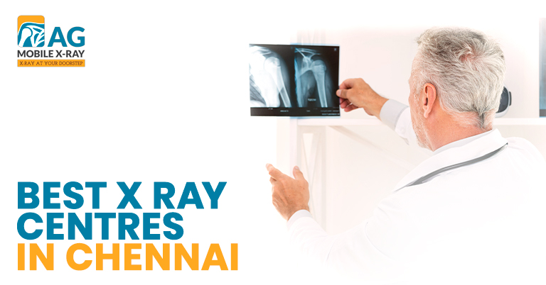 Best X Ray Centres in Chennai